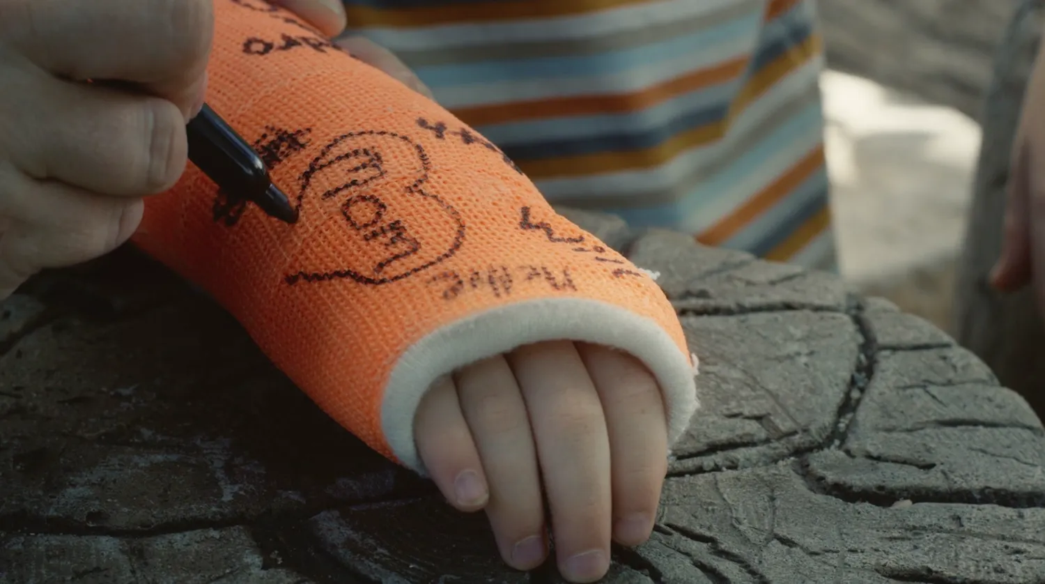 A child’s orange arm cast being signed in the BankPlus Hands & Feet spot